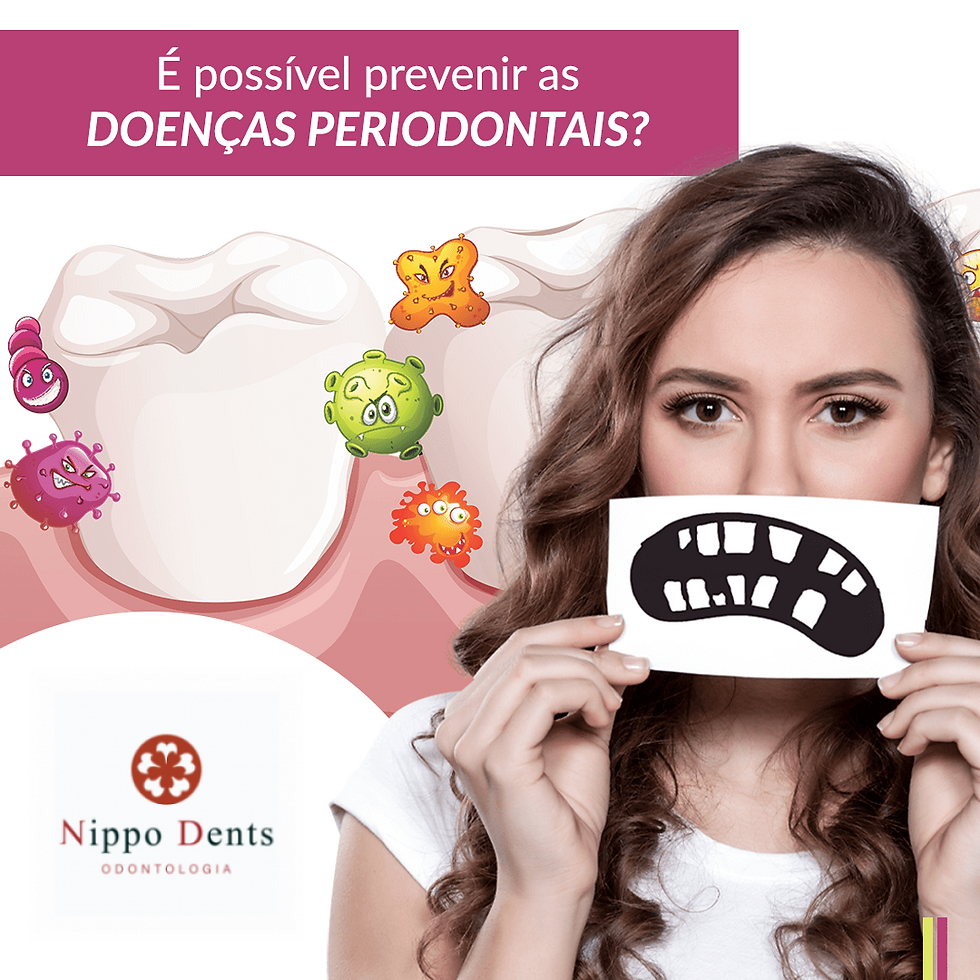 É possível prevenir as Doenças Periodontais?