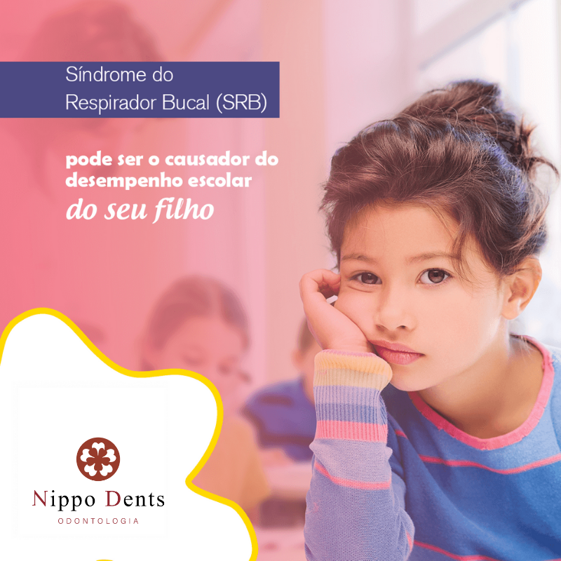 Síndrome do Respirador Bucal