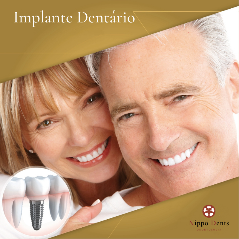 Implante Dentário