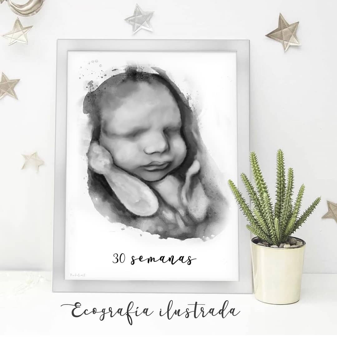 DIGITAL: Ecografía ilustrada 4D/5D