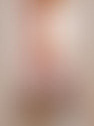 ピンクのアクセント・エコカラットで可愛らしくクリーンな空間にリフォーム｜リフォームの施工事例｜トイレ