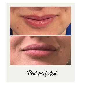 Lips