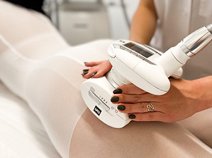 LPG Endermologie Behandlung bei SlimFit in Zürich