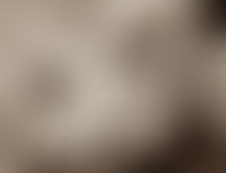 Doença de Parkinson