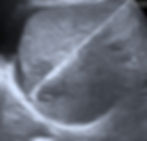 Image1_edited.jpg