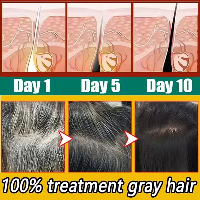 Thumbnail: Herbal Anti-grey Hair Treatment Serum Cream White To Black Permanent Repair Natu