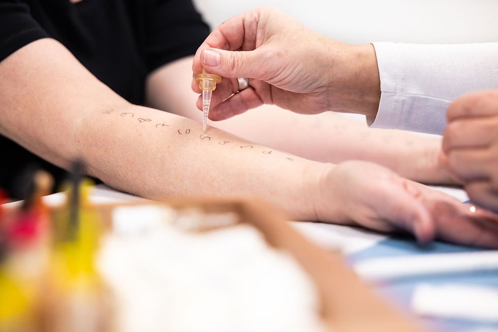 Bild von einem Hauttest mit Pippette in der dermatologischen Praxis Dr. Wallwiener Rottenburg