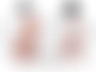 Douleur référée: votre douleur pourrait être plus grave que vous ne le pensez