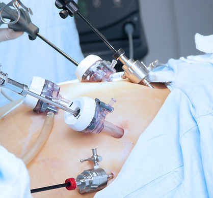 Cirurgia Videolaparoscópica