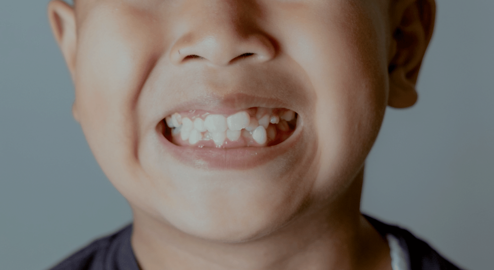Why Are My Child’s Teeth Growing Differently? Rare Pediatric Dental Conditions Explained