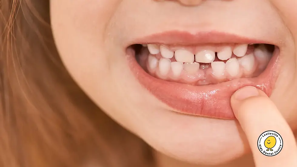 Are White Spots on Your Child’s Teeth Normal? Causes, Treatments, and Kids Dentistry Tips in Sedona, AZ”