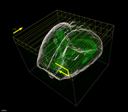 Result of MAX_grid_scan