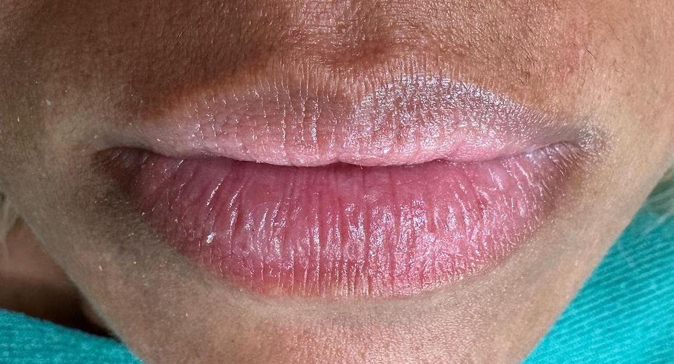 dark-lip-before-tattoo