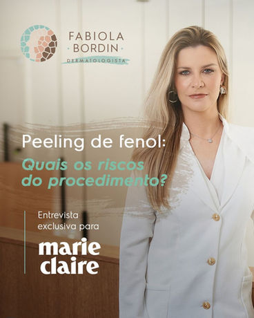 fabiola bordin explica risco do peeling de fenol