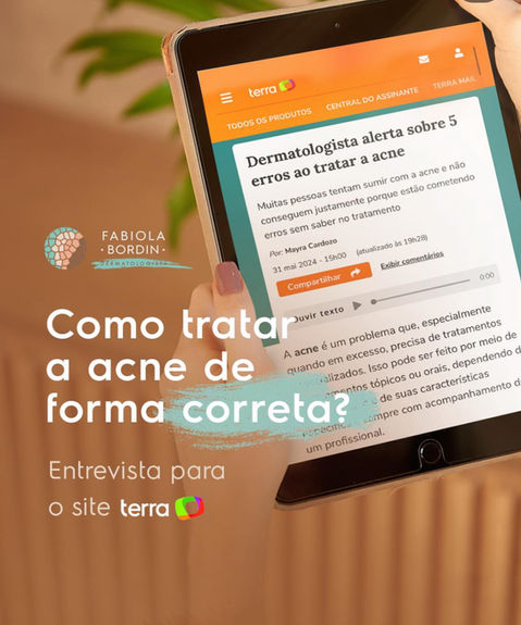 dermatologista fabiola bordin alerta 5 erros acne