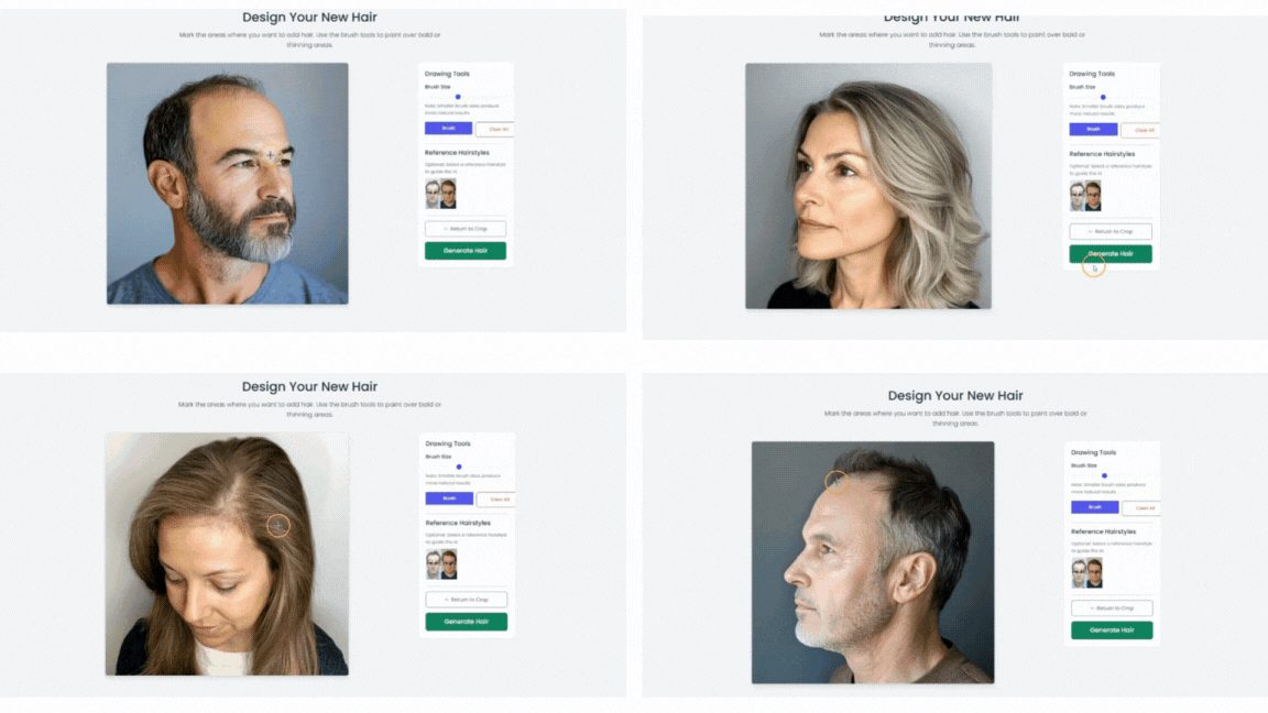 AI-BASED HAIR TRANSPLANT RESULT APP: REDEFINING VISUALIZATION WITH FUE-GEN