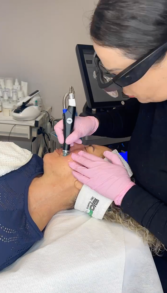 ליאת בעבודה hydrafacial
