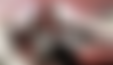 Conductor lesionado tras impactar contra poste en el periférico de la Juventud