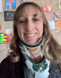 Amy Giquinto wears a neck brace after ACDF surgery.
