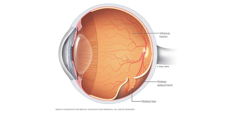 Oftalmología, oftalmólogo, oftalmóloga, centro de ojos, roca, general roca, glaucoma, presión ocular, ojo seco, nervio óptico