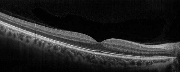 Oftalmología, oftalmólogo, oftalmóloga, centro de ojos, roca, general roca, glaucoma, presión ocular, ojo seco, nervio óptico