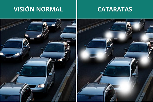 Oftalmología, oftalmólogo, oftalmóloga, centro de ojos, roca, general roca, glaucoma, presión ocular, ojo seco, nervio óptico