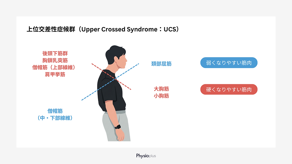 上位交差性症候群(Upper Crossed Syndrome:UCS)の模式図。頭部前方位姿勢に伴い、硬くなりやすい筋肉(後頭下筋群、胸鎖乳突筋、僧帽筋上部線維、肩甲挙筋、大胸筋、小胸筋)と、弱くなりやすい筋肉(頸部屈筋、僧帽筋中・下部線維)の筋バランスを交差パターンで示している。提供:フィジオプラス。