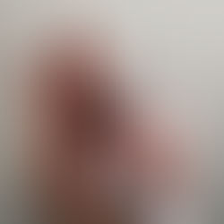 Ingrandimento del pene con filler: quali sono i reali vantaggi?