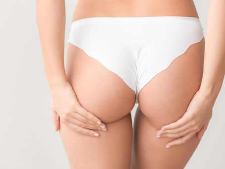 Tutto sullo sbiancamento anale