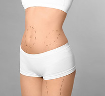 liposcultura