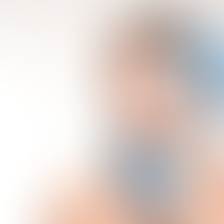 Come prevenire il photoaging