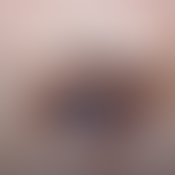 Glaucoma: la enfermedad silenciosa que puede afectar tu visión 👁️⚠️