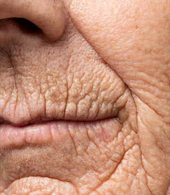 Skin firmness concerns