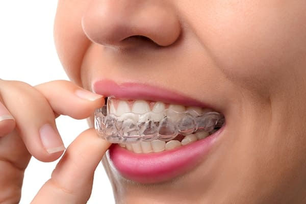Protector dental para el bruxismo