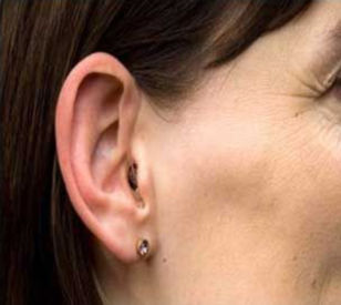 Smallest Hearing Aid_edited.jpg