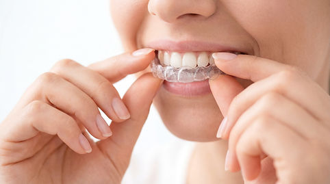 A person is smiling while fitting a clear dental aligner over their teeth