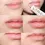 Thumbnail: Before and After Effects of Dong-A Pharm - Noscarna Acne Scars Removal Gel