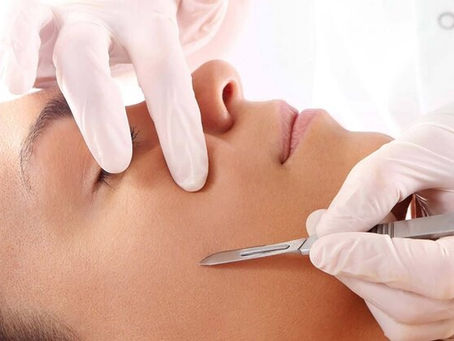 professional dermaplaning by a certified licensed esthetician