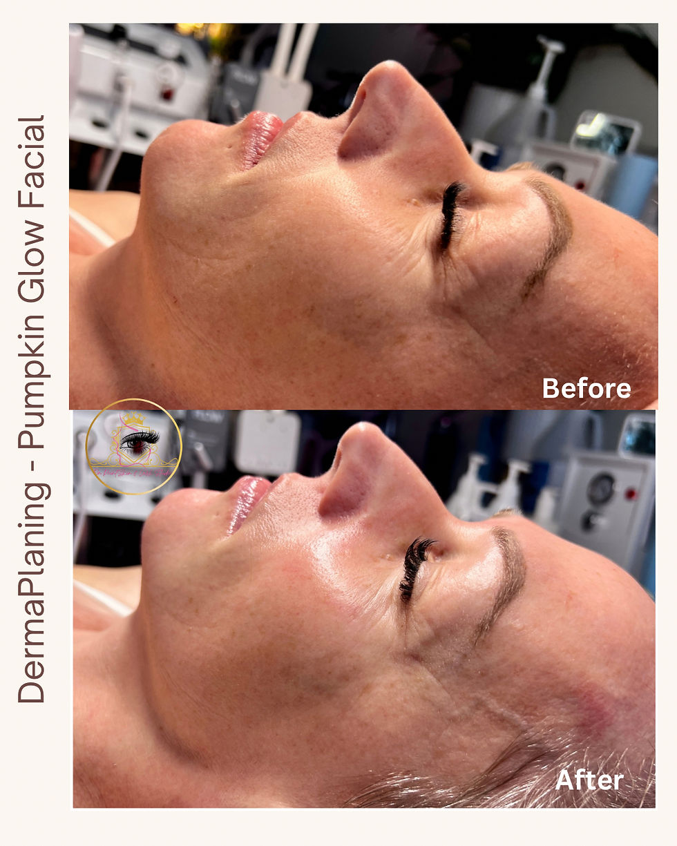 Two side-by-side images show a woman's face before and after a dermaplaning pumpkin glow facial. Text reads "DermaPlaning - Pumpkin Glow Facial."