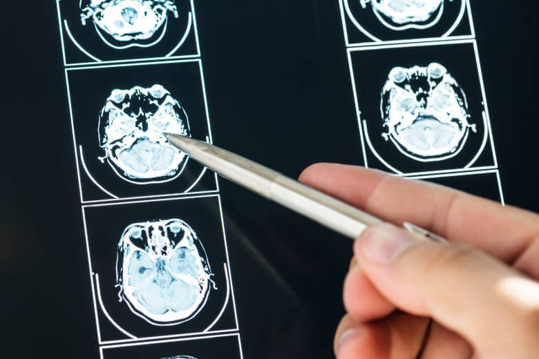 Neurologista_780x520.jpeg