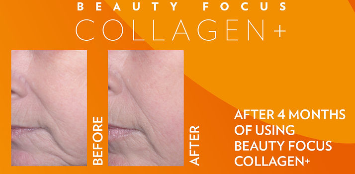 beauty-focus-collagen-plus-only-before-a