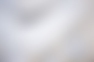 Antihistamines and Their Role in Managing Mast Cell Activation Syndrome (MCAS)