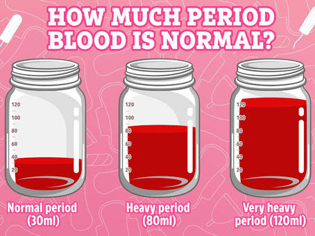 Understanding the Connection Between MCAS and Heavy Periods