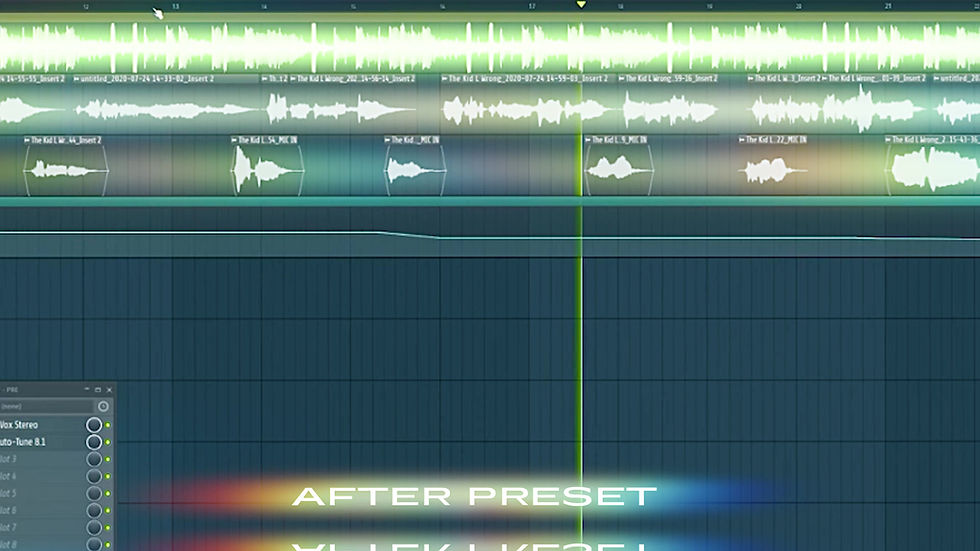 Thumbnail: The Kid Laroi Vocal Template