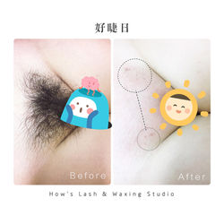 私密處除毛｜All Of