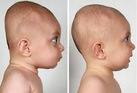 Cranial Conundrums (yes, that's a fancy way of saying head problems...)