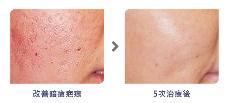 Finexel-BA-Photos_工作區域-1-1.png