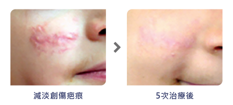 Finexel-BA-Photos-02.png