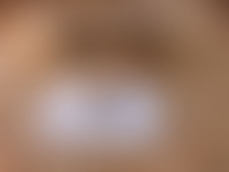 【文風筆動】天灸療法淺談