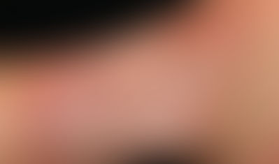 【田間醫話】濕疹的從何而來